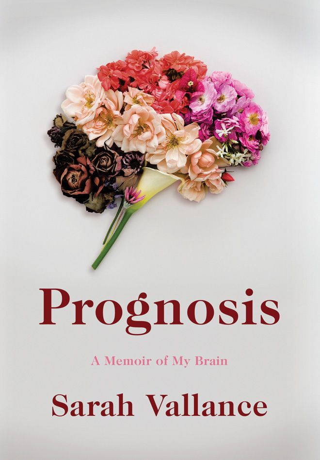 Prognosis: A Memoir of My Brain Buchen