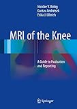 MRI of the Knee: A Guide to Evaluation and Reporting (English Edition) livre