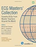 ECG Masters’ Collection: Favorite ECGs from Master Teachers Around the World livre