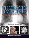 Thoracic Imaging: Pulmonary and Cardiovascular Radiology livre