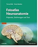 Fotoatlas Neuroanatomie livre