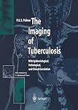 The Imaging of Tuberculosis: With Epidemiological, Pathological, and Clinical Correlation (English E livre
