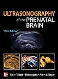 Ultrasonography of the Prenatal Brain, Third Edition livre