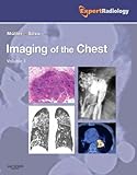 Imaging of the Chest, 2-Volume Set: Expert Radiology Series livre
