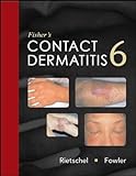 Fisher's Contact Dermatitis livre