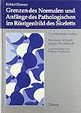 Grenzen des Normalen und Anfänge des Pathologischen im Röntgenbild des Skeletts livre